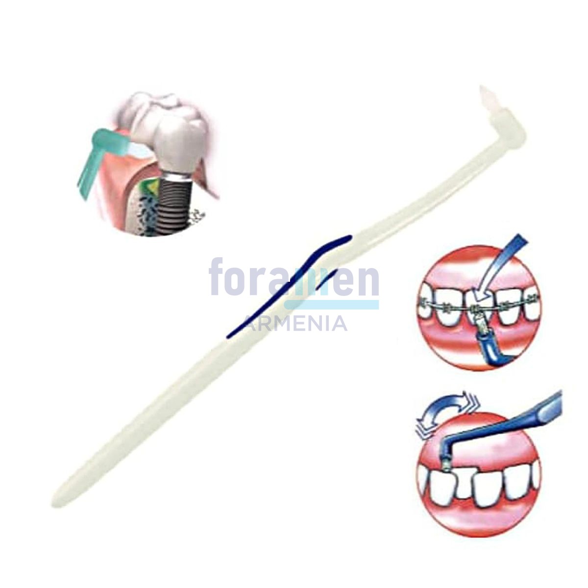 Toothbrush «Mono Tuft»